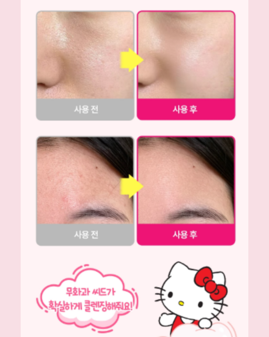 plu × hello kittyfig seed glow peel foam Гуужуулагчтай хөөсөн цэвэрлэгч plu × hello kittyfig seed glow peel foam Гуужуулагчтай хөөсөн цэвэрлэгч